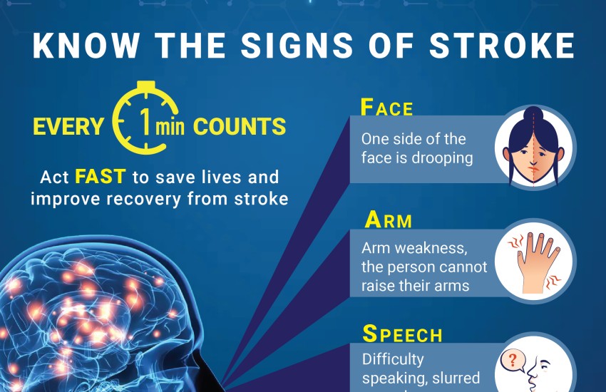 Know the Signs of Stroke